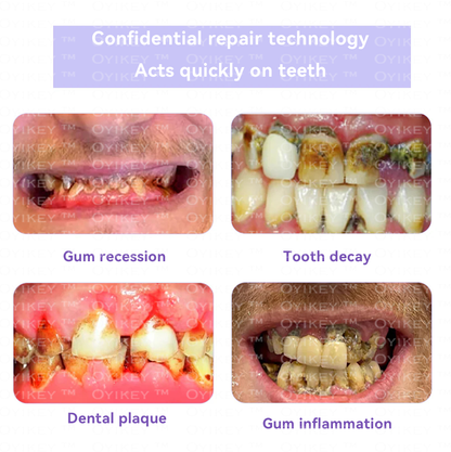 Oyikey™💟 TOOTH RESTORATION MINERAL POWDER(ADA recommended)