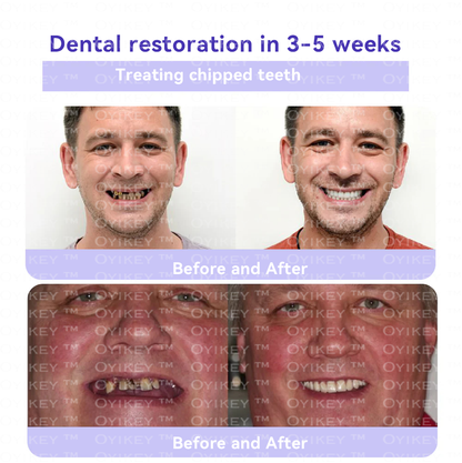 Oyikey™💟 TOOTH RESTORATION MINERAL POWDER(ADA recommended)
