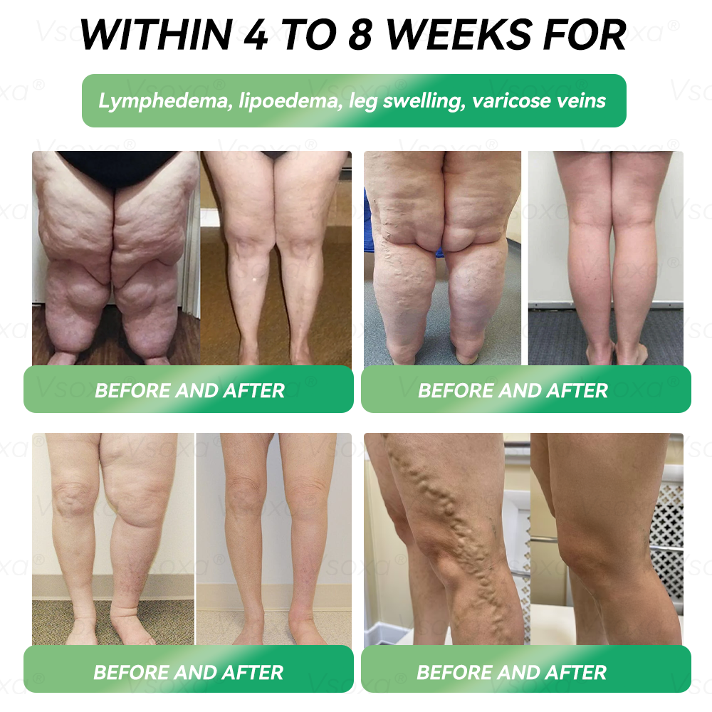⏰ Only 1 Spot Left! 🔥 Extra 30% OFF!👨‍⚕️𝑉𝑠𝑜𝑥𝑎® 𝐺𝐿𝑃-1 𝑀𝑖𝑐𝑟𝑜𝑐𝑎𝑝𝑠𝑢𝑙𝑒 𝐵𝑢𝑟𝑠𝑡 𝑃𝑎𝑡𝑐ℎ